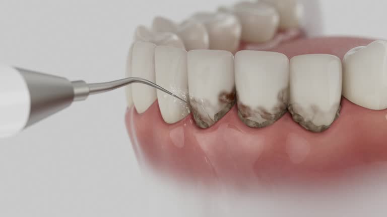 Trusted Tooth Extraction service in Big Lake, AK - Dentist Open Now